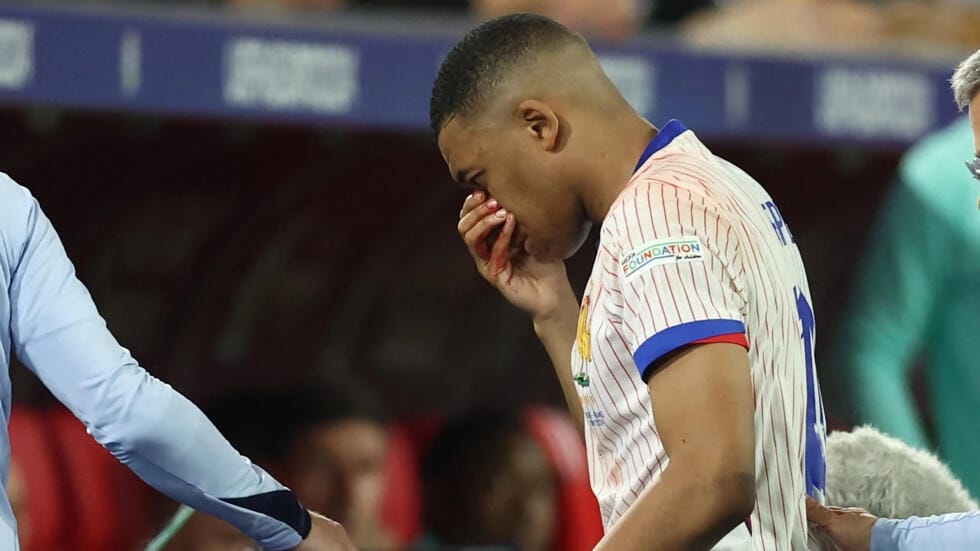 Kylian Mbappé blessé mais optimiste pour la suite de l'Euro 2024